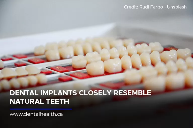 Dental-implants-closely-resemble-natural-teeth