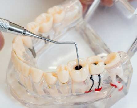 Root Canal Treatment Kingsway Family Dentistry Ontario