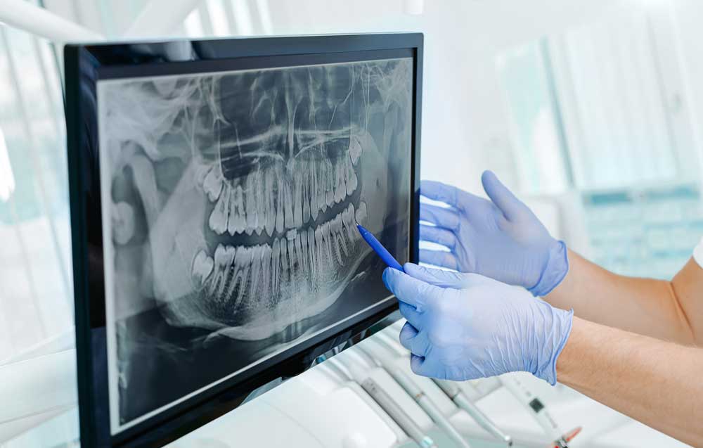 Why Visit a Professional Family Dentist