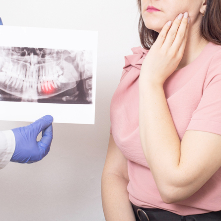 Wisdom Tooth Extraction Kingsway Family Dentistry