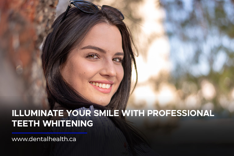 Illuminate your smile with professional teeth whitening