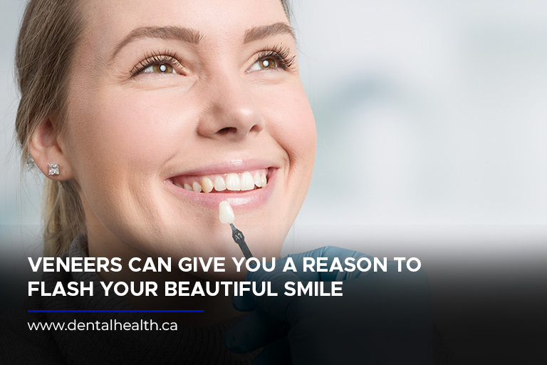 Veneers can give you a reason to flash your beautiful smile