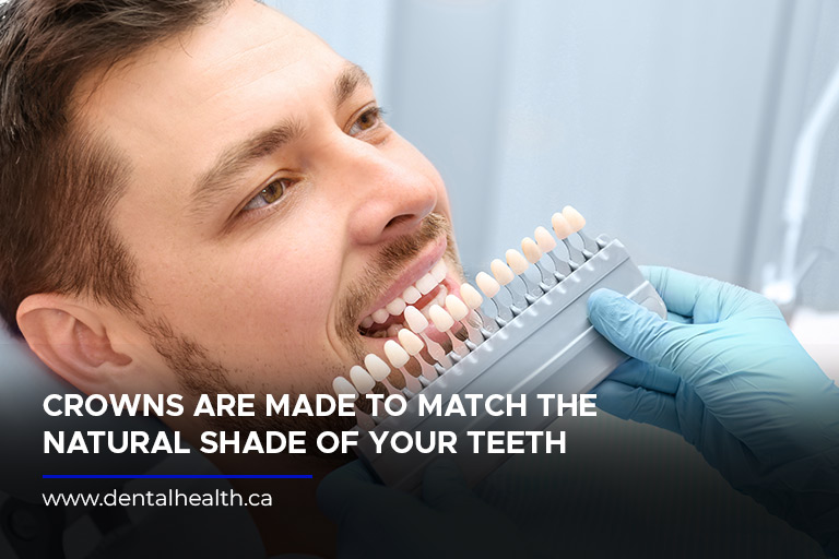 Crowns are made to match the natural shade of your teeth