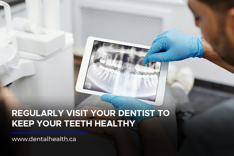 Regularly visit your dentist to keep your teeth healthy