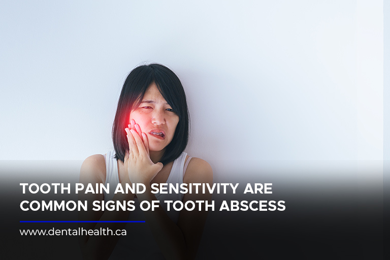 Tooth pain and sensitivity are common signs of tooth abscess
