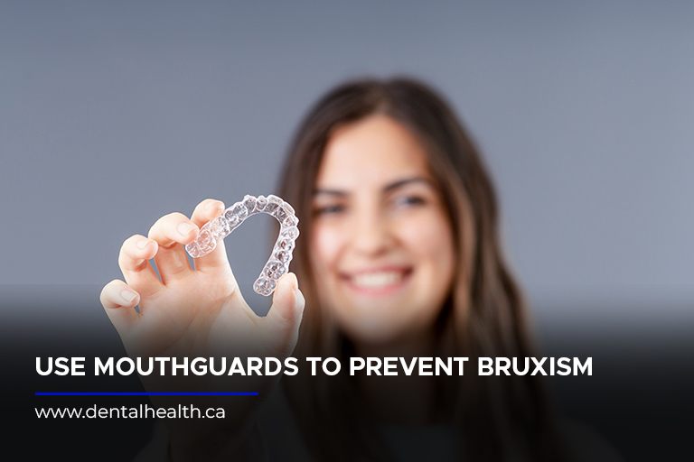 Use mouthguards to prevent bruxism