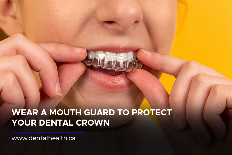 Wear a mouth guard to protect your dental crown