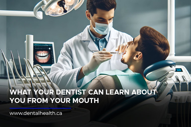 What Your Dentist Can Learn About You from Your Mouth