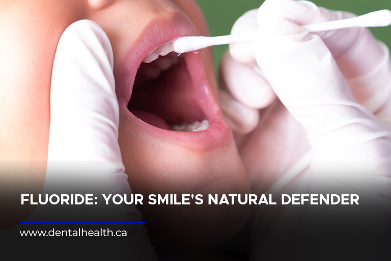 Fluoride: Your Smile's Natural Defender