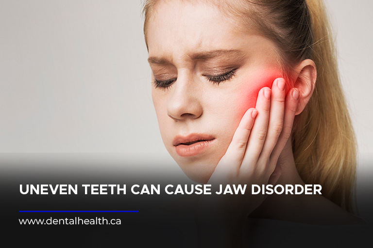 Uneven teeth can cause jaw disorder