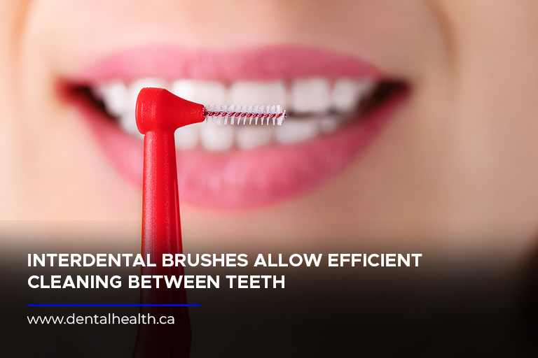 Interdental brushes allow efficient cleaning between teeth