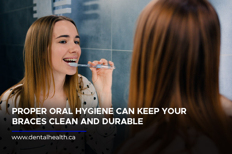 Proper oral hygiene can keep your braces clean and durable