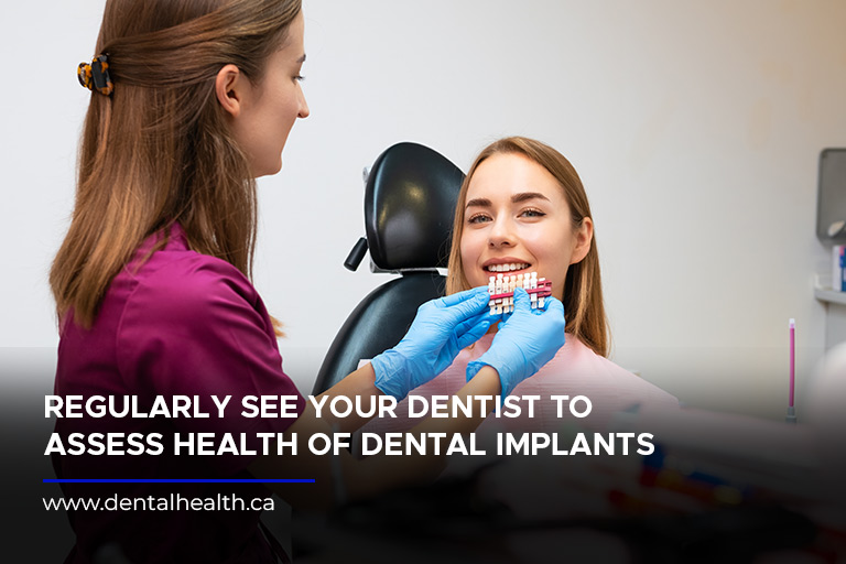 Regularly see your dentist to assess health of dental implants