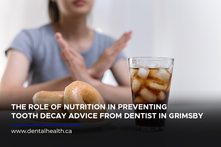 The Role of Nutrition in Preventing Tooth Decay: Advice from Dentist in Grimsby