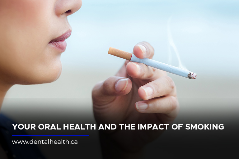 Your Oral Health and the Impact of Smoking