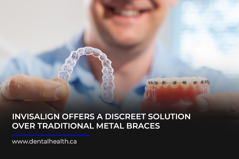 Invisalign-offers-a-discreet-solution-over-traditional-metal-braces