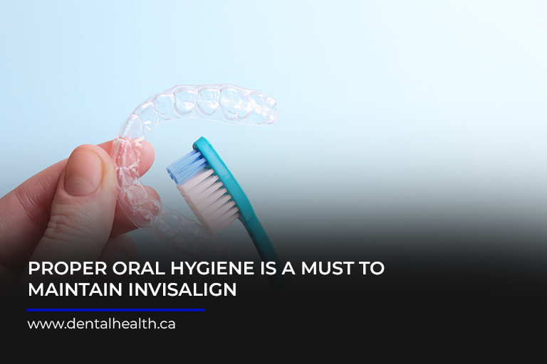 Proper-oral-hygiene-is-a-must-to-maintain-Invisalign