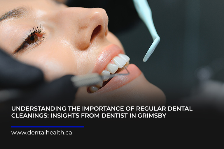 Understanding the Importance of Regular Dental Cleanings Insights from Dentist in Grimsby