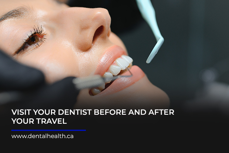 Visit-your-dentist-before-and-after-your-travel