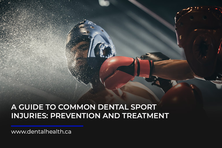 A-Guide-to-Common-Dental-Sport-Injuries-Prevention-and-Treatment