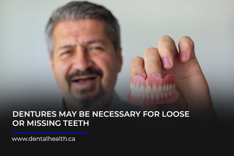 Dentures may be necessary for loose or missing teeth