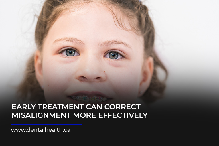 Early-treatment-can-correct-misalignment-more-effectively