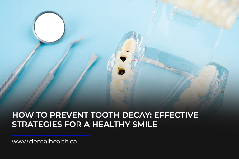 How-to-Prevent-Tooth-Decay-Effective-Strategies-for-a-Healthy-Smile