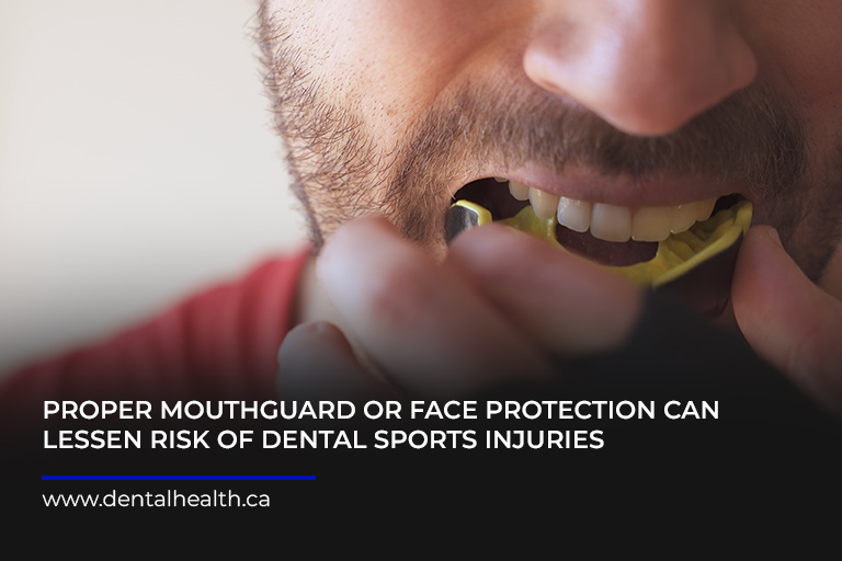 Proper-mouthguard-or-face-protection-can-lessen-risk-of-dental-sports-injuries