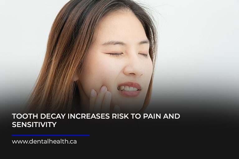 Tooth-decay-increases-risk-to-pain-and-sensitivity