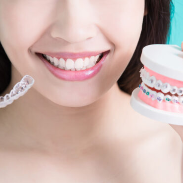 Braces-vs.-Invisalign-Which-is-Right-for-You