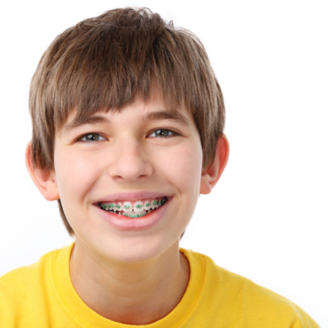 Braces
