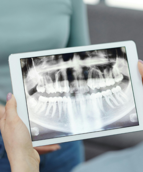 dental x-rays