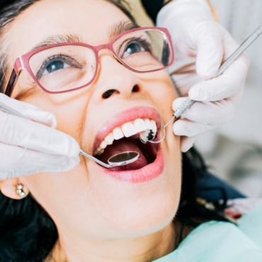 fillings