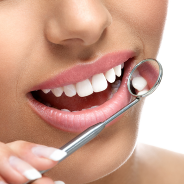 teeth-whitening