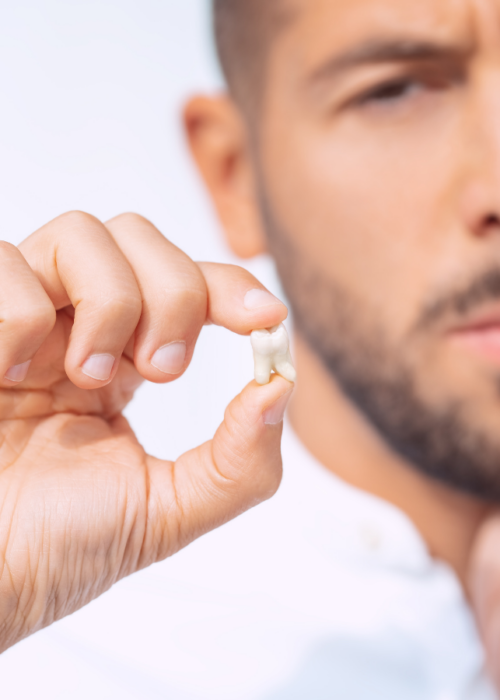tooth extraction